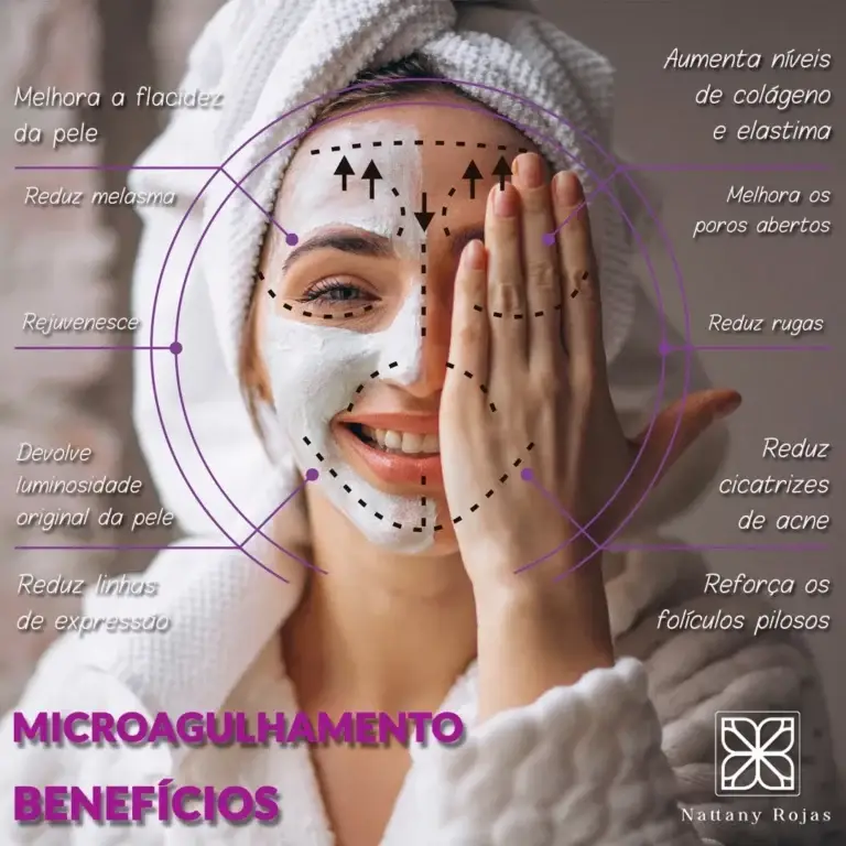 microagulhamento-beneficios